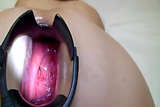 Gaping
